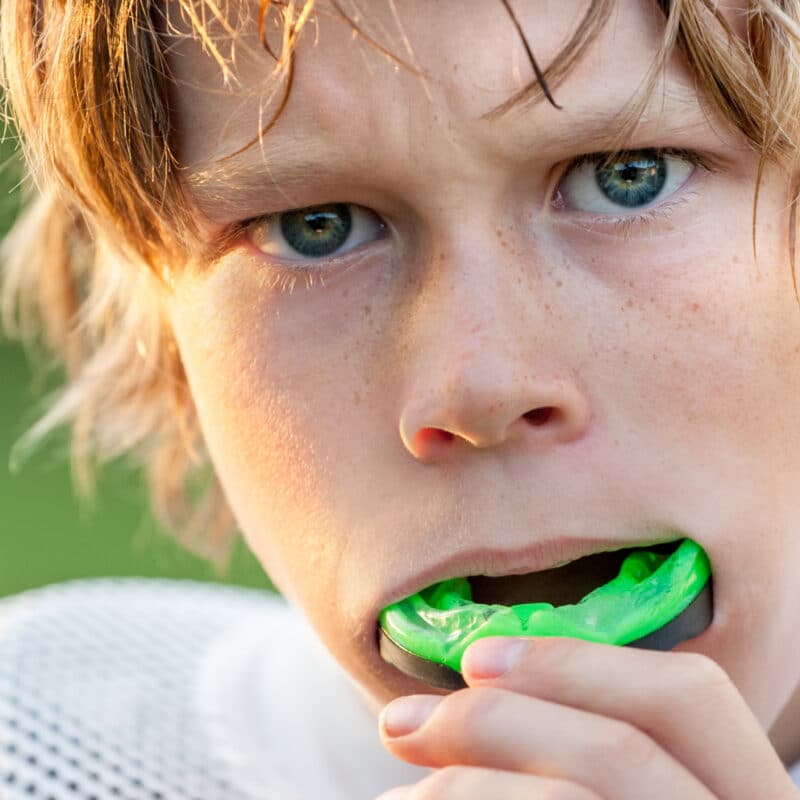 Sports Mouthguards for Kids San Francisco: Why Protection Matters