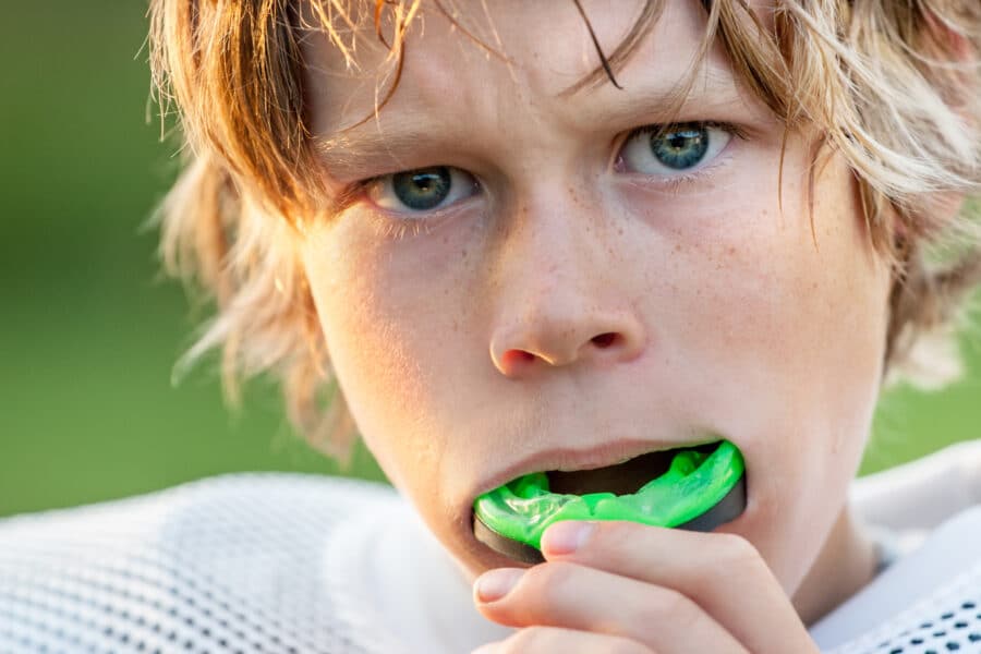 Sports Mouthguards for Kids San Francisco: Why Protection Matters