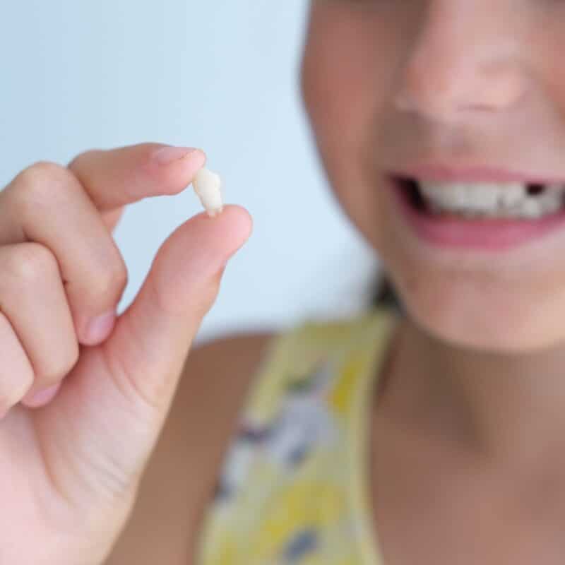 tooth extraction for kids