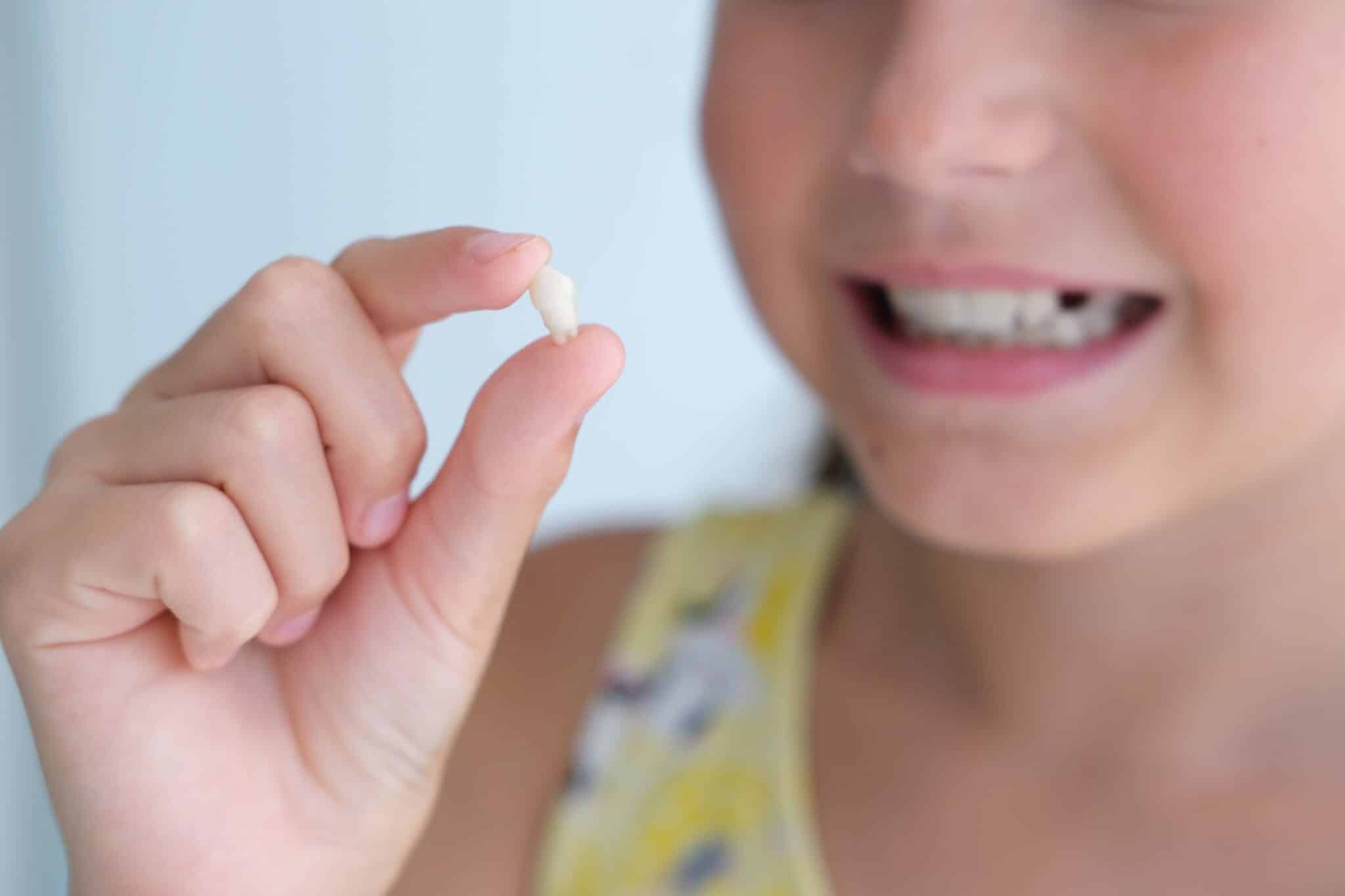 Pediatric Tooth Extraction San Francisco For Parents